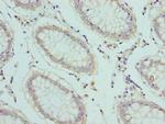SLC1A6 Antibody in Immunohistochemistry (Paraffin) (IHC (P))