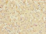 SLC6A12 Polyclonal Antibody