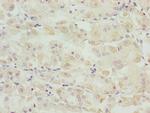 SNAP29 Polyclonal Antibody