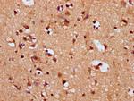 SNRPE Antibody in Immunohistochemistry (Paraffin) (IHC (P))