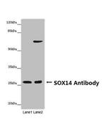 SOX14 Antibody in Western Blot (WB)