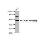 SPOPL Antibody in Western Blot (WB)