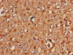 SPRY2 Antibody in Immunohistochemistry (Paraffin) (IHC (P))