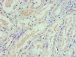 SPTLC1 Polyclonal Antibody