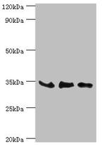 SRM Antibody in Western Blot (WB)