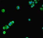 SSRP1 Polyclonal Antibody