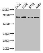 SSRP1 Antibody in Western Blot (WB)