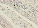 STAM2 Antibody in Immunohistochemistry (Paraffin) (IHC (P))