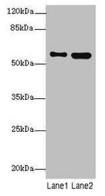 STAM2 Antibody in Western Blot (WB)