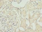 TAGLN2 Polyclonal Antibody