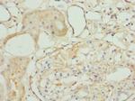 TAGLN2 Polyclonal Antibody
