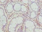 TARS Polyclonal Antibody