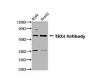 TBX4 Polyclonal Antibody