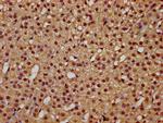 CA150 Polyclonal Antibody