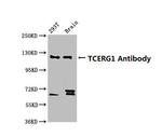 CA150 Antibody in Western Blot (WB)