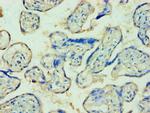 TDP1 Polyclonal Antibody