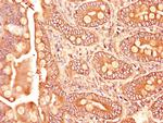TGFBR1 Antibody in Immunohistochemistry (Paraffin) (IHC (P))