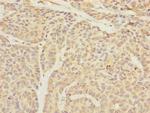 TIMM23 Polyclonal Antibody