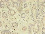 TK1 Polyclonal Antibody