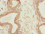 TMEM161A Antibody in Immunohistochemistry (Paraffin) (IHC (P))