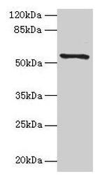 TMEM161A Antibody in Western Blot (WB)