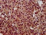 TMEM192 Antibody in Immunohistochemistry (Paraffin) (IHC (P))