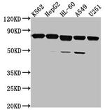 TMEM214 Polyclonal Antibody