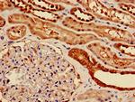 ENO1 Antibody in Immunohistochemistry (Paraffin) (IHC (P))