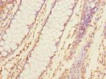 TNFAIP8 Antibody in Immunohistochemistry (Paraffin) (IHC (P))
