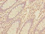 TNFAIP8 Polyclonal Antibody