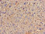 TOM1 Antibody in Immunohistochemistry (Paraffin) (IHC (P))