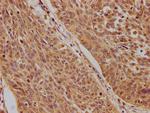 p73 Polyclonal Antibody
