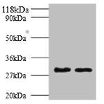 TPSB2 Polyclonal Antibody