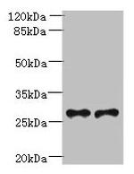 TREM2 Polyclonal Antibody