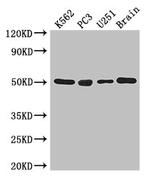 TUBA1C Antibody in Western Blot (WB)