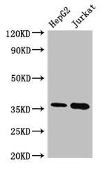Thymidylate Synthase Antibody in Western Blot (WB)