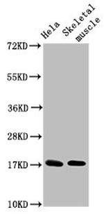 UBE2D3 Polyclonal Antibody