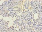 UBE2G2 Polyclonal Antibody