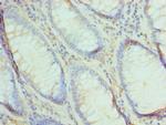 UBE2V2 Polyclonal Antibody