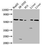 UGT1A1 Polyclonal Antibody