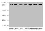 USP5 Antibody in Western Blot (WB)