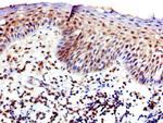 WASP Antibody in Immunohistochemistry (Paraffin) (IHC (P))