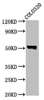 WASP Antibody in Western Blot (WB)