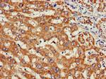 WISP3 Antibody in Immunohistochemistry (Paraffin) (IHC (P))