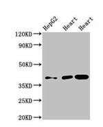 WISP3 Antibody in Western Blot (WB)