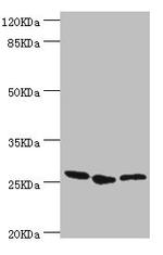 GAS41 Polyclonal Antibody
