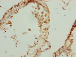 ZBTB25 Antibody in Immunohistochemistry (Paraffin) (IHC (P))
