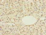 ZNF297B Polyclonal Antibody