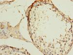 ZNF297B Antibody in Immunohistochemistry (Paraffin) (IHC (P))