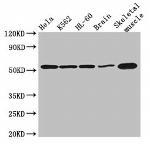 ZNF297B Antibody in Western Blot (WB)